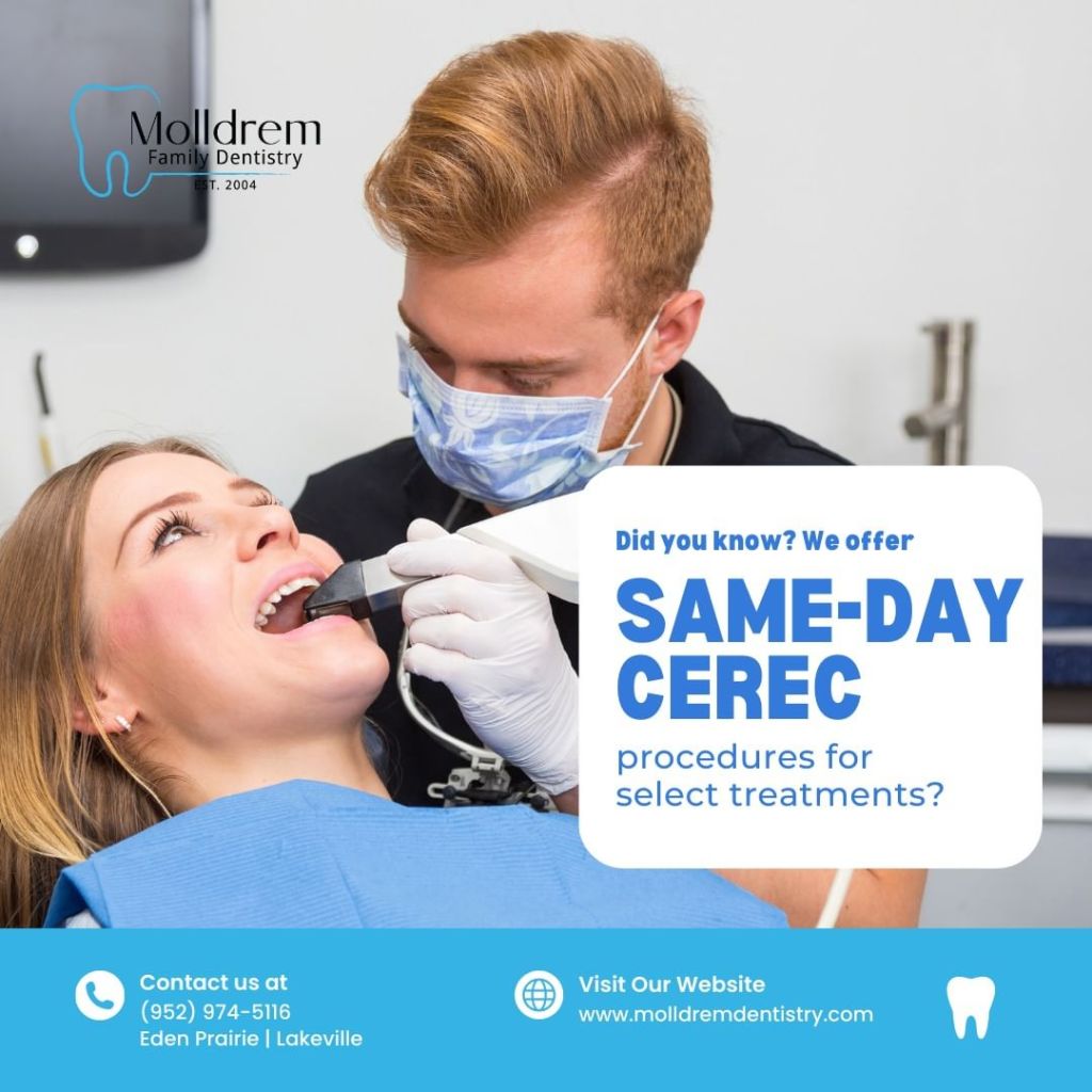 Seamless Smiles: How Kevin Molldrem Dentist And Molldrem Family Dentistry Lead With Same-Day CEREC Crowns
